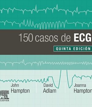 43462-150 CASOS DE ECG 5 EDICION