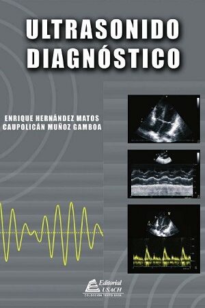 51766-ULTRASONIDO DIAGNOSTICO